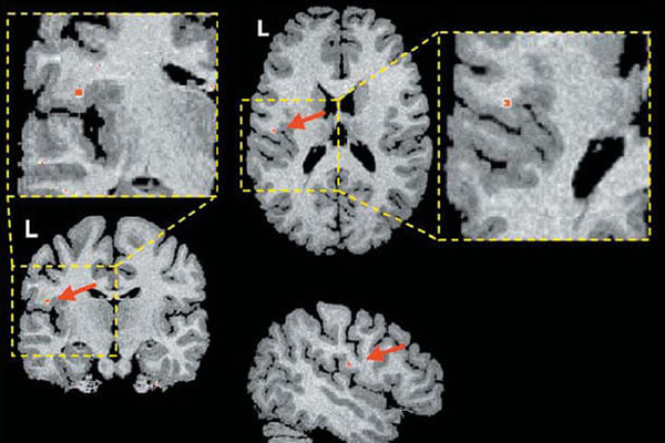Radiografias do cérebro